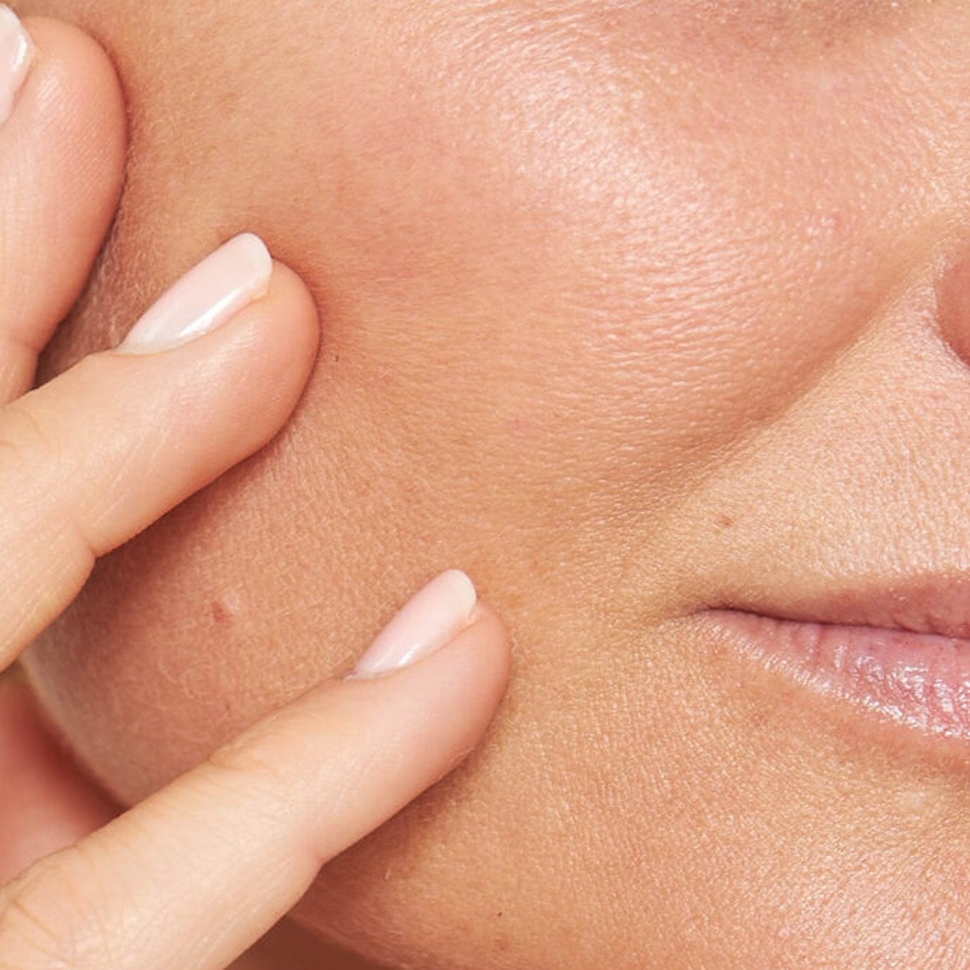 skin improvement
